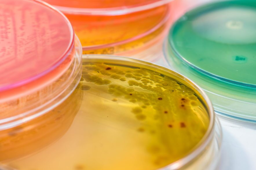 Pathogen growth on selective media.